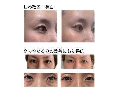 【cocoroBe:】ムービングリンクルケアクリーム